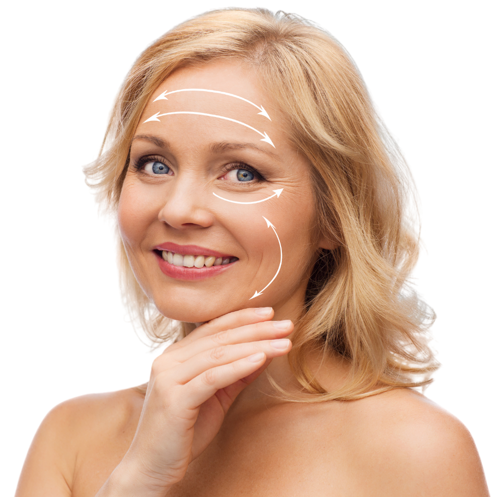 Facelift